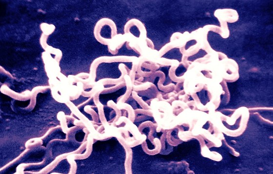 Původcem pohlavně přenosné infekční nemoci syfilis je bakterie Treponema...