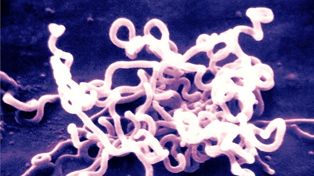 Původcem pohlavně přenosné infekční nemoci syfilis je bakterie Treponema pallidum (na snímku).