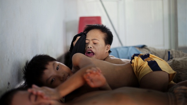 Děti v rehabilitačním centru v Danangu, které kvůli chemikálií rozprašovaným za vietnamské války trpí různými postiženími (9. srpna 2012)