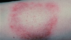 Ilustra�ní snímek