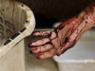 Mu zranný pi bojích v syrském Aleppu (13. záí 2012)