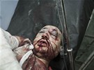 Syrský mu zranný bhem boj v Aleppu (22. záí 2012) 