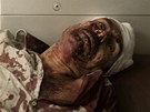 Syrský mu zranný pi bojích v Aleppu (22. záí 2012)