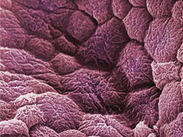 Detail bunk výstelky moového mchýe