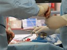 Kardiologická operace zúené chlopn novou metodou ve Fakultní nemocnici v...