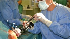 Neurochirurgové z Fakultní nemocnice Olomouc provádjí unikátní operaní postup