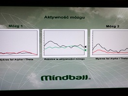 Grafy mozkové aktivity ze zaízení Mindball. 