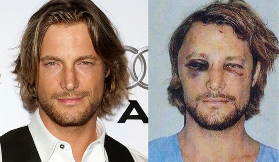 Model Gabriel Aubry ped a po útoku herce Oliviera Martineze