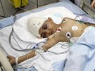 Palestintí politici na návtv nemocnice v Pásmu Gazy  (21. listopadu 2012)