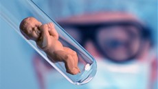 Ilustra�ní snímek