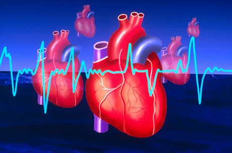 Lékai zvládají nové metody nápravy nedostatené funkce srdce. Ilustraní snímek