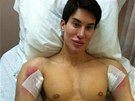 Justin Jedlica po jedné ze svých operací