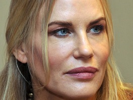 Hereka Daryl Hannah má upravenou bradu, horní ret a v oblieji spoustu botoxu.