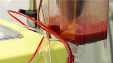 Nový pístroj umí odsát krev pímo z rány pacienta, vyistí jí a vrátí jí zpt