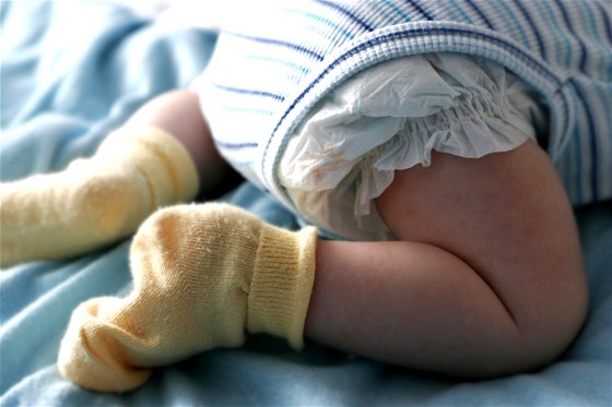 Základem zdravé ke kojenc je asté pebalování, obzvlá v letních msících (ilustraní foto).