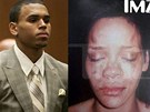 Chris Brown a fotografie jeho bývalé pítelkyn Rihanny zveejnná poté, co ji...