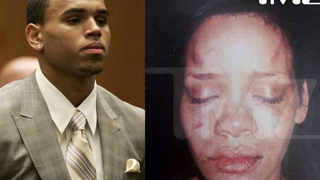 Chris Brown a fotografie jeho bval ptelkyn Rihanny zveejnn pot, co ji zpvk napadl (2009). 