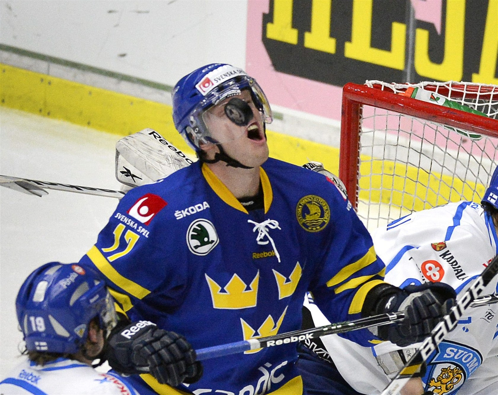 �védský hokejista Carl Söderberg schytal zásah pukem do hlavy. 