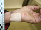 Zlodj pi pepadení seniorku lehce zranil na ruce.