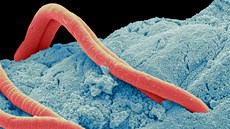 Roup d�tský pod mikroskopem