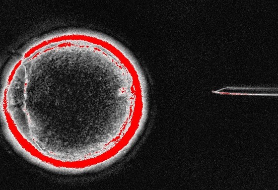 Záběr z procedury vytvoření embryonálních kmenových buněk. Nově objevené STAP buňky by měly umožnit práci bez jehel.