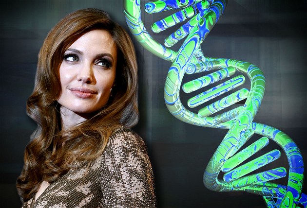 Angelina Jolie si kv�li riziku rakoviny prsu nechala odstranit z prsou mlé�né