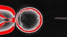Zábr z procedury vytvoení embryonálních kmenových bunk vdci z Oregonské...