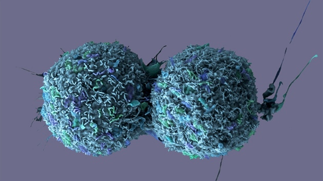 Kultivované buňky rakoviny plic

