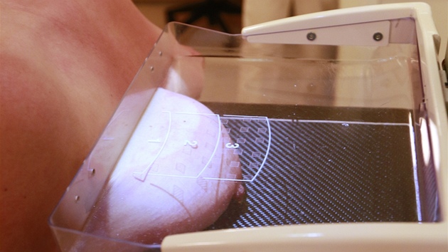 Při snímkování je prs stlačen průsvitnou plastovou deskou. 