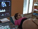 Léka na ultrazvuku kontroluje srdení akci miminek i prtok krve. 