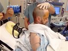 Brad Carter trpl esenciálním tesem a musel podstoupit operaci mozku.