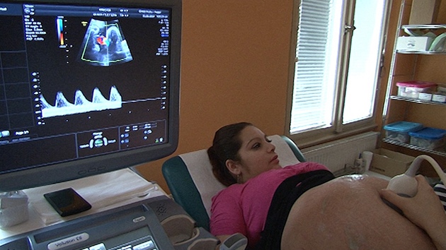 Lka na ultrazvuku kontroluje srden akci miminek i prtok krve. 