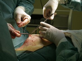 Lékai zaívají ez, který je posledním krokem operace. 