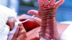 Ob�as si vytrhnou hadi�ku, pohybov� bývají stejn� �ivé jako dono�ená miminka. 