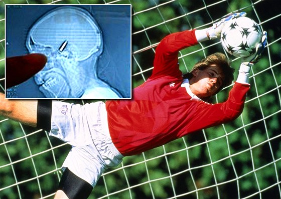Sarajevský fotbalový branká odchytal zápas s kulkou v hlav.