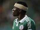 Kenneth Omeruo z Nigérie si v duelu s Uruguayí poranil hlavu.