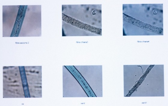 Forenzní analýza vlasů, chlupů a vláken (ilustrační snímek)