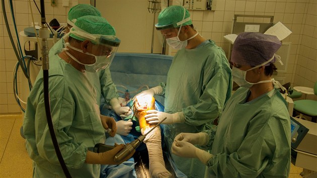První česká operace, při níž lékaři Vsetínské nemocnice pacientovi vyměnili část kolenního kloubu s využitím speciálních šablon.