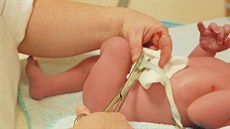 Pupení ra se bn pestíhává do minuty po narození (ilustraní snímek).