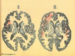 Pitevn zprva mue, kterho 21. srpna roku 1968 na jihlavskm nmst srazil