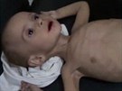 Dti v Sýrii strádají hladem.
