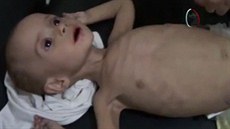 Dti v Sýrii strádají hladem.