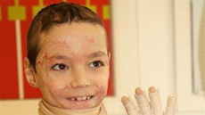 Nadace Na�e dít� umo�nila lé�bu osmiletého Daniela. Ten se zranil p�i h�e a za...
