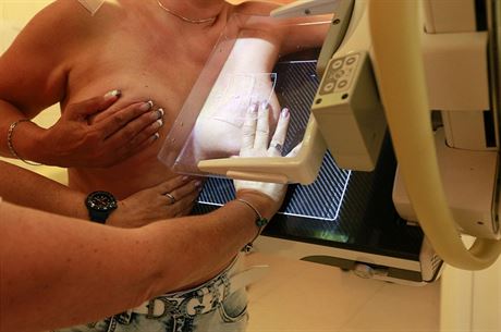 Pojiovny zaznamenaly zvýený zájem o preventivní vyetení. Snímek je z vyetení prsu mamografem. Ilustraní foto.