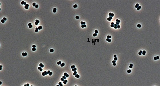 Tersicocus Phoenics pod mikroskopem