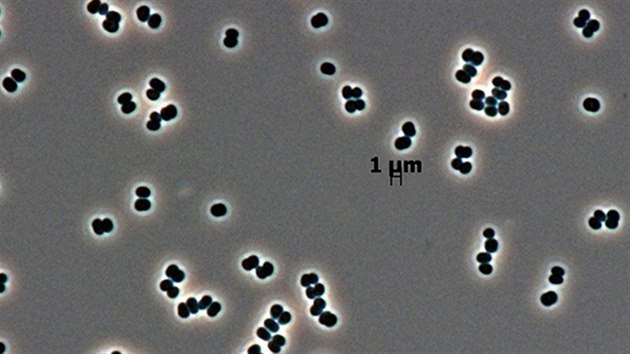 Tersicocus Phoenics pod mikroskopem