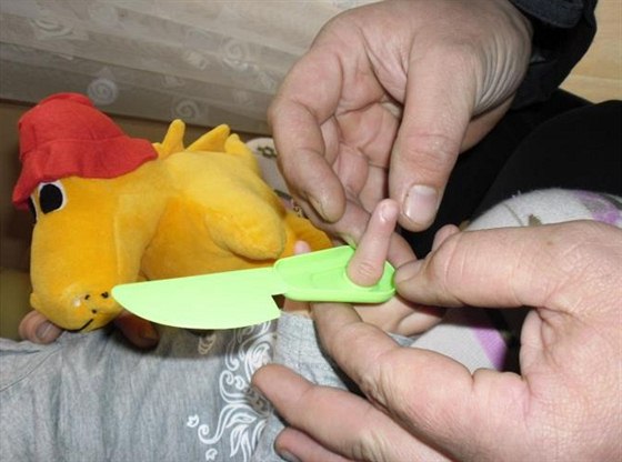 Zaseknutý prst malé dívky v plastovém noži.
