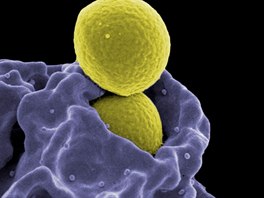 Bílá krvinka obaluje "zlatého stafylokoka" (žlutě), aby mohla bakterii zničit.