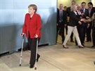 Angela Merkelová musela chodit o berlích u v dubnu 2011, kdy podstoupila...