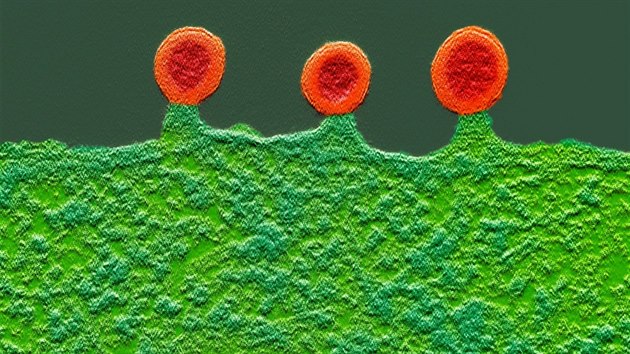 Buka infikovaná virem HIV. Dodaten obarvený snímek z elektronového...